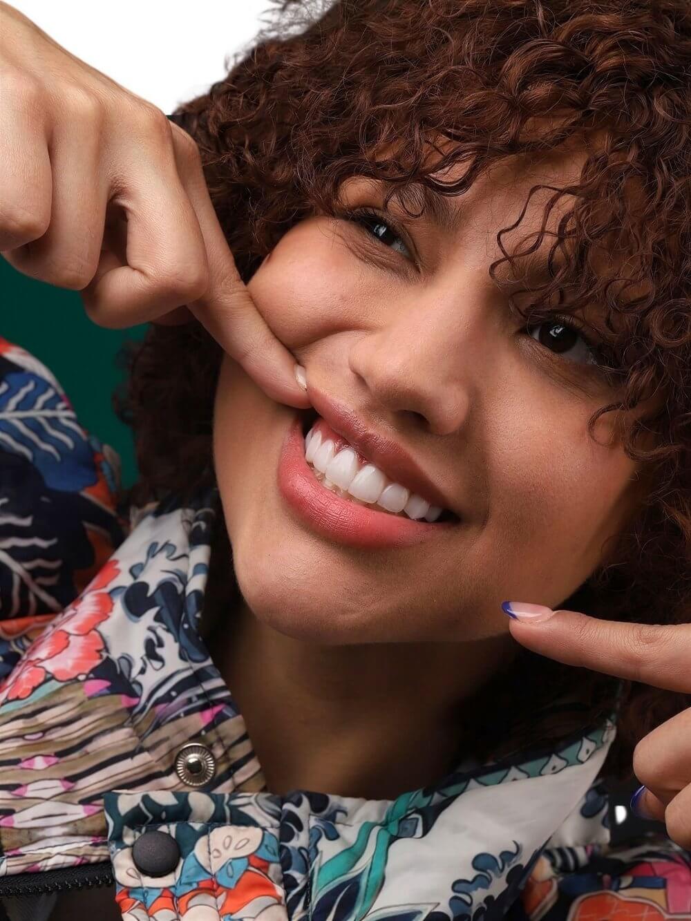 Smile Dental Miami - Porcelain Veneers